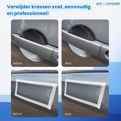 Krasverwijderaar Pro Set